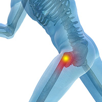 Maryland Center For ARC | Back Pain, Migraine/Tension Headache and Botox