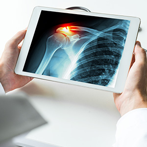 Maryland Center For ARC | Hip, IV Infusions and Back Pain