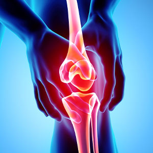 Baltimore The Advanced Arthritis Relief Protocol™